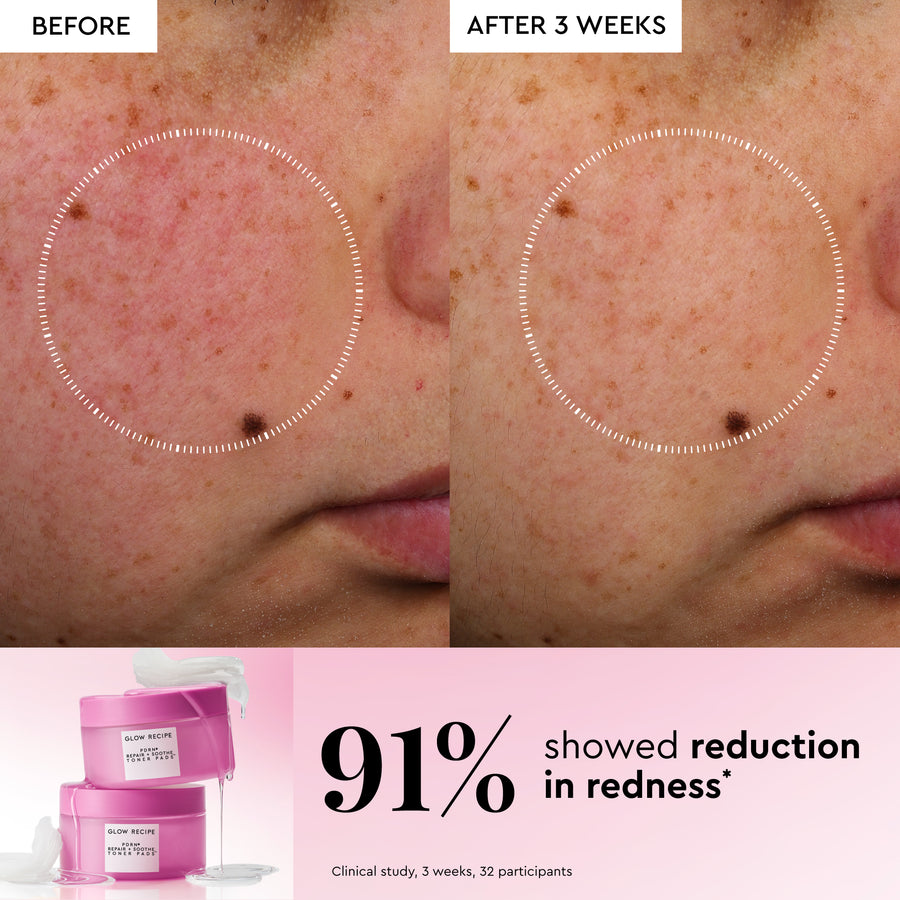 almohadillas tónicas coreanas pdrn repair soothe